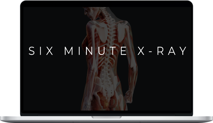 6-Minute X-Ray