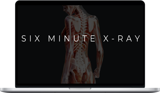 6-Minute X-Ray